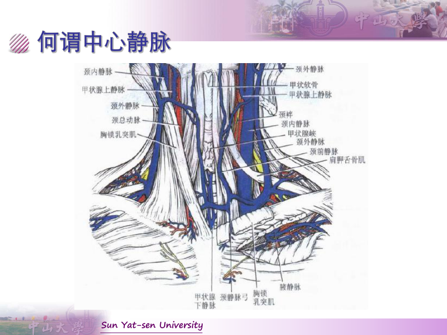 CVC置管与护理(新版)课件.pptx_第2页