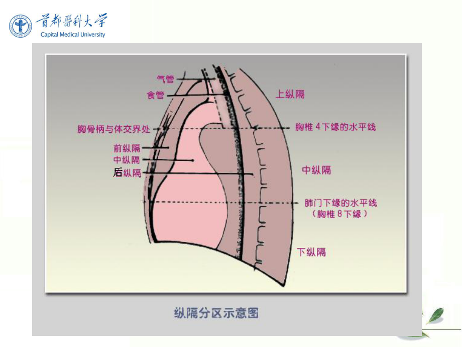 《影像诊断学》教学课件：第七节-纵膈肿瘤.ppt_第2页