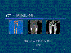 CT下肢静脉造影（放射科）课件.ppt