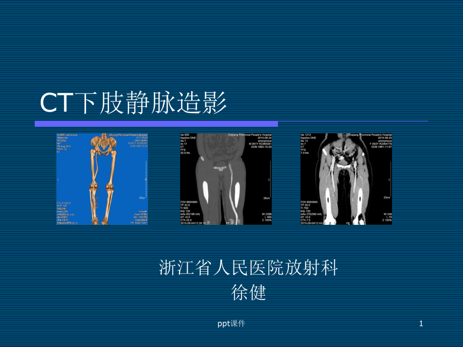 CT下肢静脉造影（放射科）课件.ppt_第1页