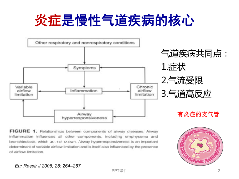 一氧化氮呼气测定的临床意义和应用课件.ppt_第2页