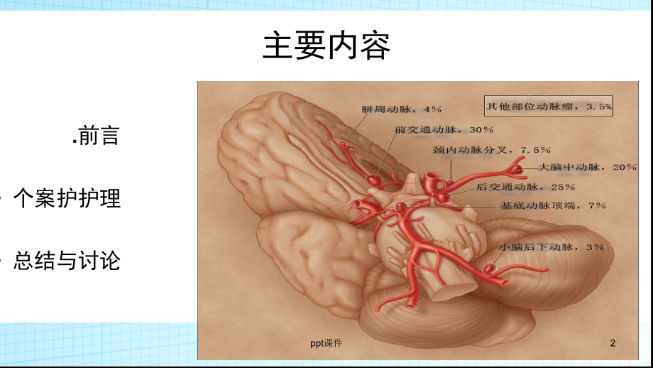 一例动脉瘤头痛的个案护理课件.ppt_第2页