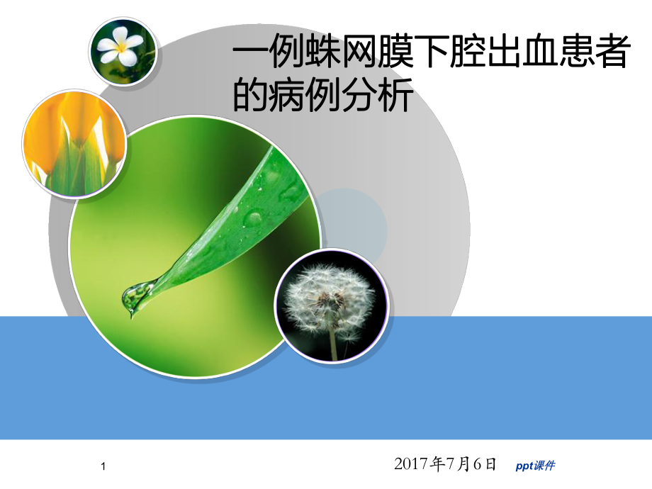 一例蛛网膜下腔出血患者的病例分析课件.ppt_第1页