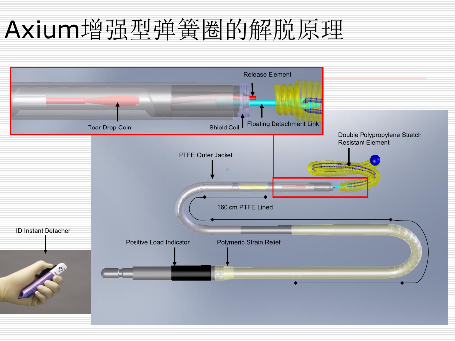 Axium弹簧圈栓塞动脉瘤课件.ppt_第3页