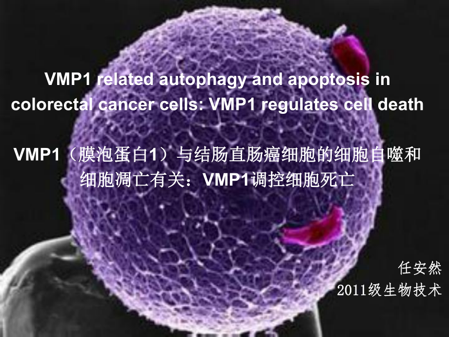 VMP1-regulates-cell-death-VMP1(膜泡蛋白1)与结肠直肠癌细胞的课件.ppt_第2页