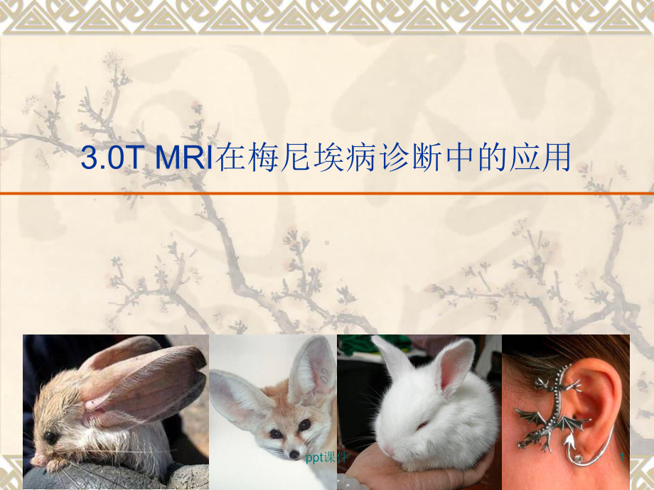 30T-MRI在(内耳)梅尼埃病诊断中的应用课件.ppt_第1页