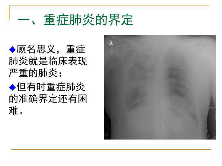 最新重症肺炎的诊治-张伟课件.ppt_第3页