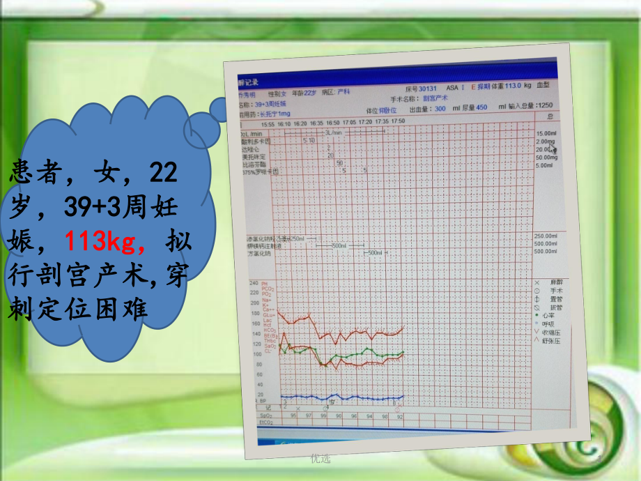 资料浅谈肥胖患者的麻醉处理x课件.pptx_第1页