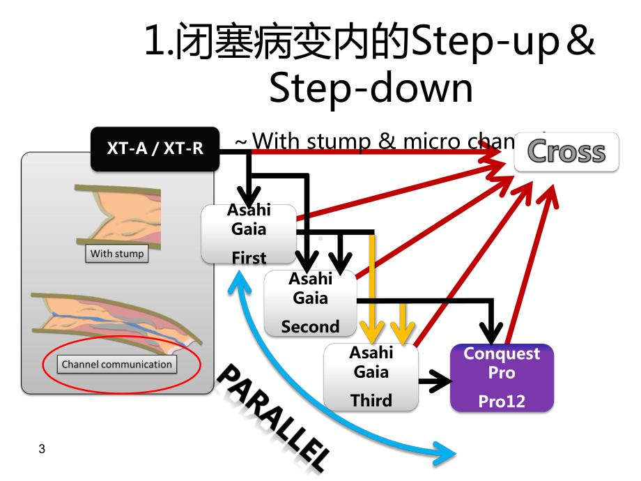 北京大学国际医院-心内科-王光亮-GAIA-与-XT-系列导丝的使用区别课件.ppt_第3页