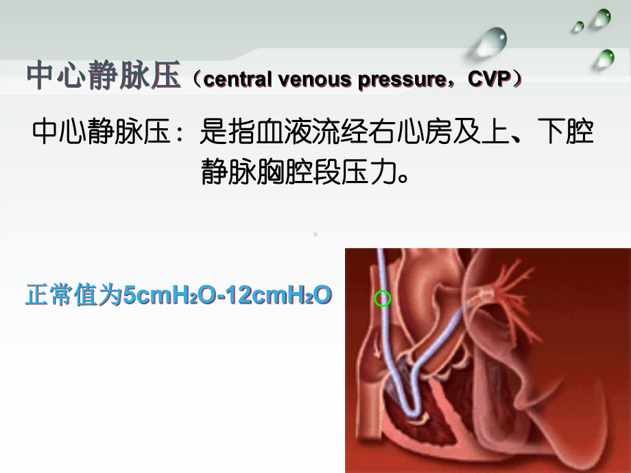 中心静脉压(CVP)的监测课件.ppt_第3页