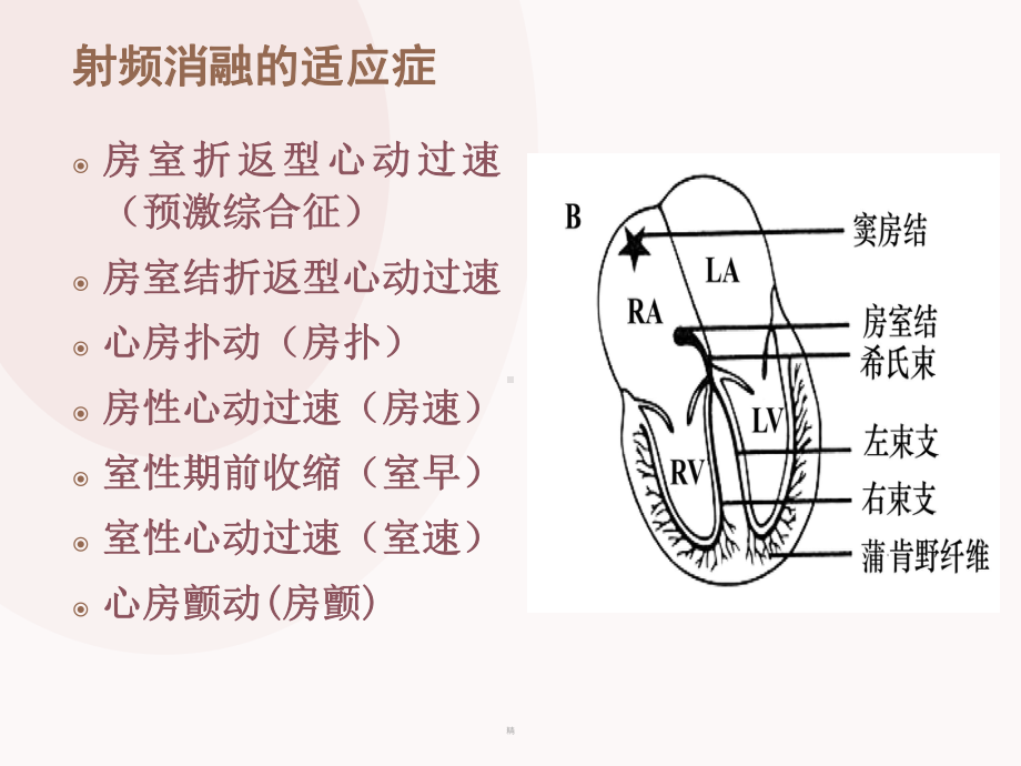 心脏射频消融术的护理课件.ppt_第3页