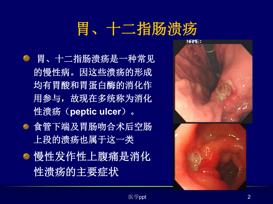 腹部常见病变的主要症状和体征课件.ppt_第2页