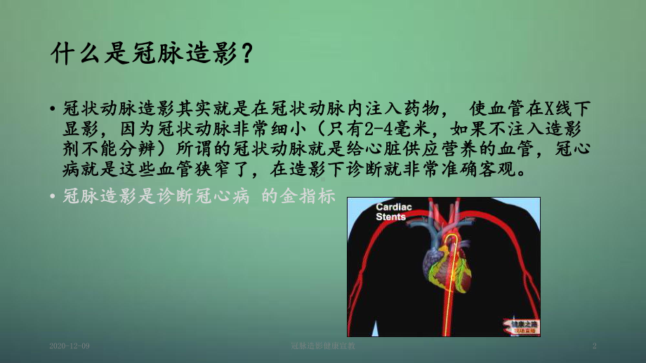 冠脉造影健康宣教(课件).ppt_第2页