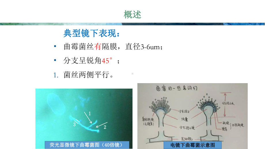 常见曲霉菌简介演示教学课件.ppt_第3页