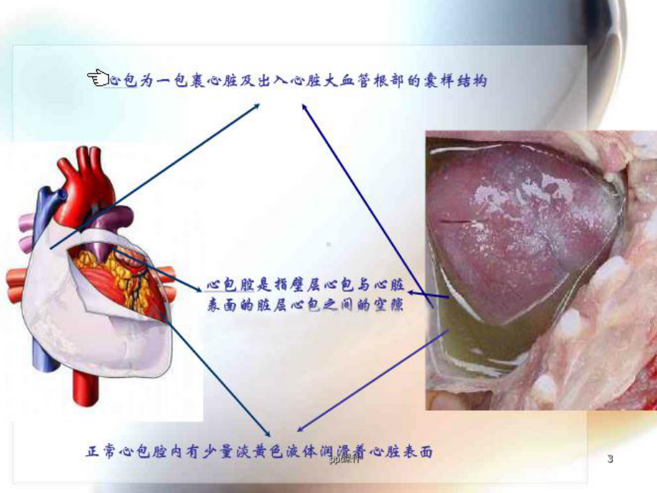 心包压塞课件.ppt_第3页