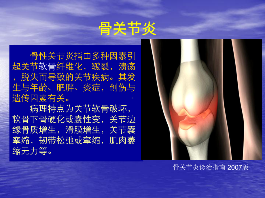 膝关节OA分级治疗课件.ppt_第3页