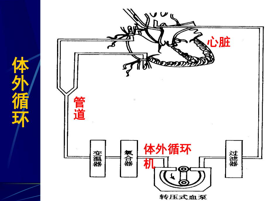 心脏外科课件.ppt_第3页