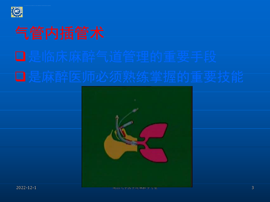 全身麻醉和气管插管课件.ppt_第3页