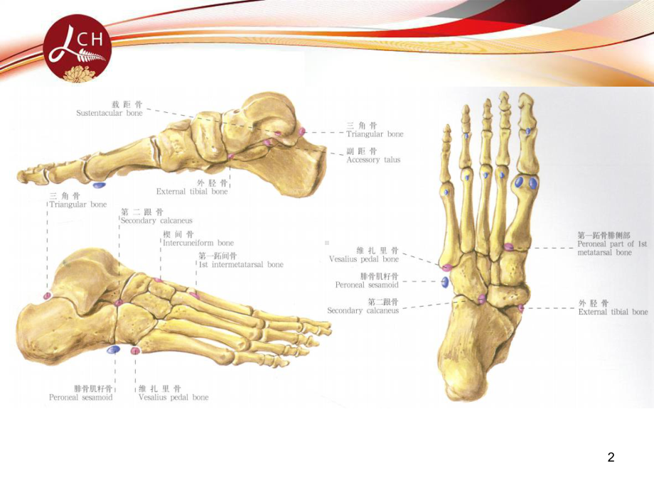足部副骨与籽骨演示教学课件.ppt_第2页