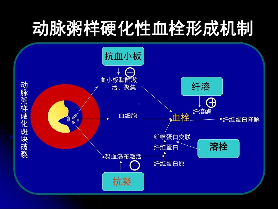 脑梗死抗凝治疗解读课件.ppt_第3页