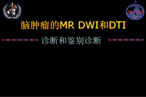 脑肿瘤的MR-DWI和DTI诊断和鉴别诊断课件.ppt