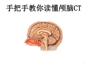 手把手教你读懂颅脑CT演示教学课件.ppt