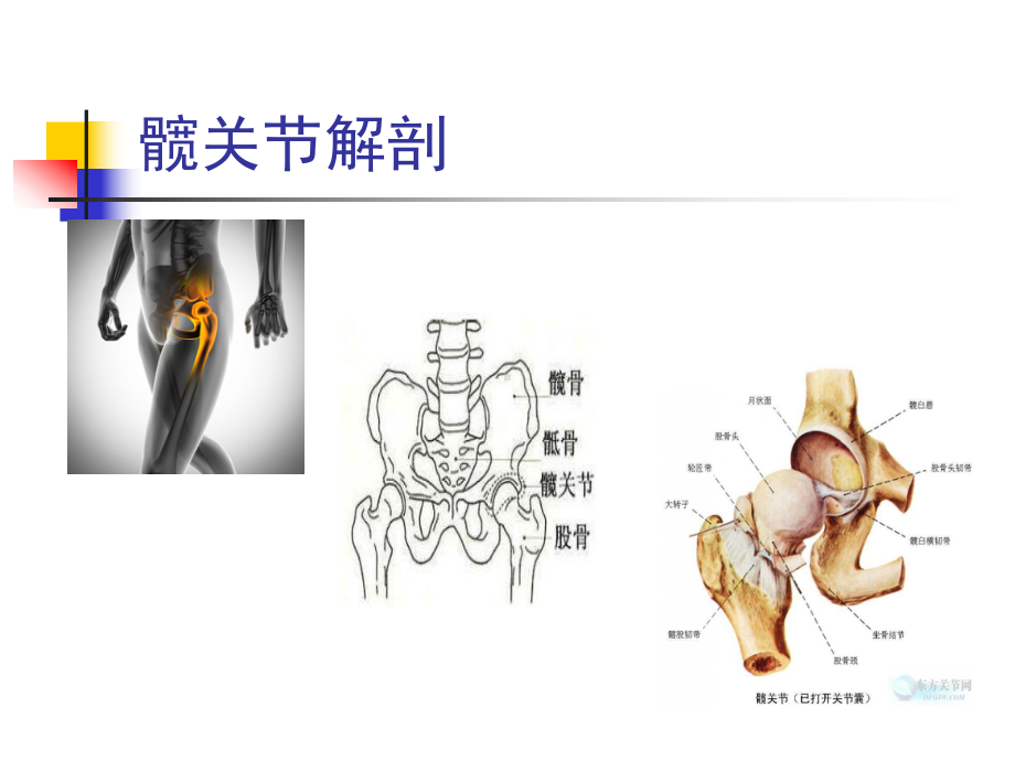 负压引流技术为骨科手术最常见课件.ppt_第3页