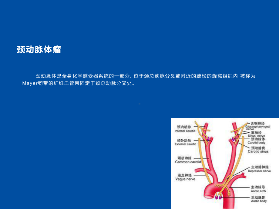 颈动脉鞘区解剖及病变的病理和影像学表现课件.ppt_第2页