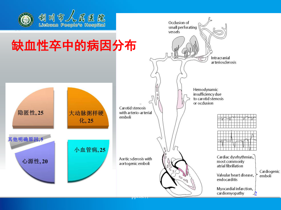 心源性卒中的抗栓治疗课件.ppt_第2页