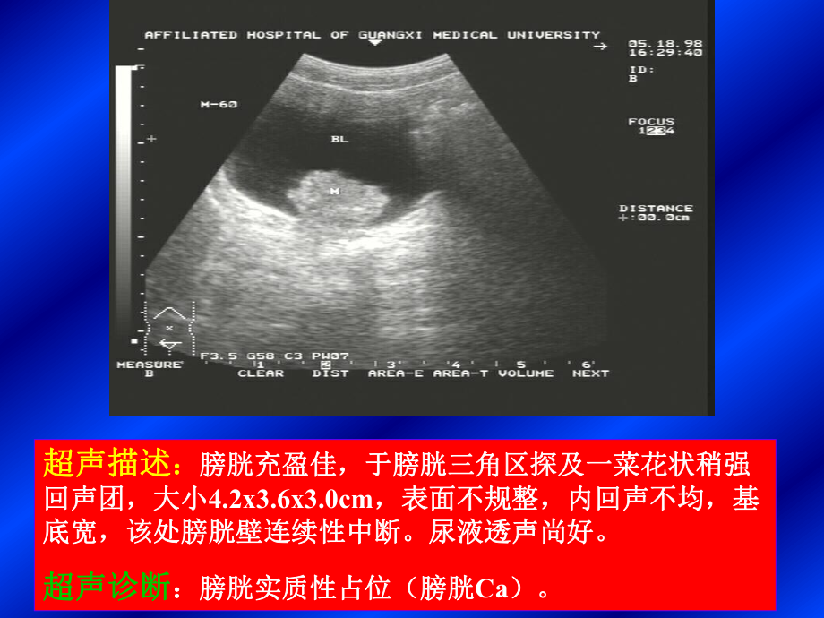 超声诊断报告课件.ppt_第2页