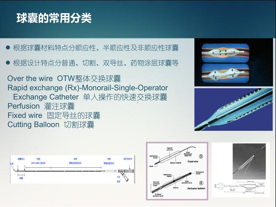 最新介入治疗中球囊作用及进展课件.ppt_第2页