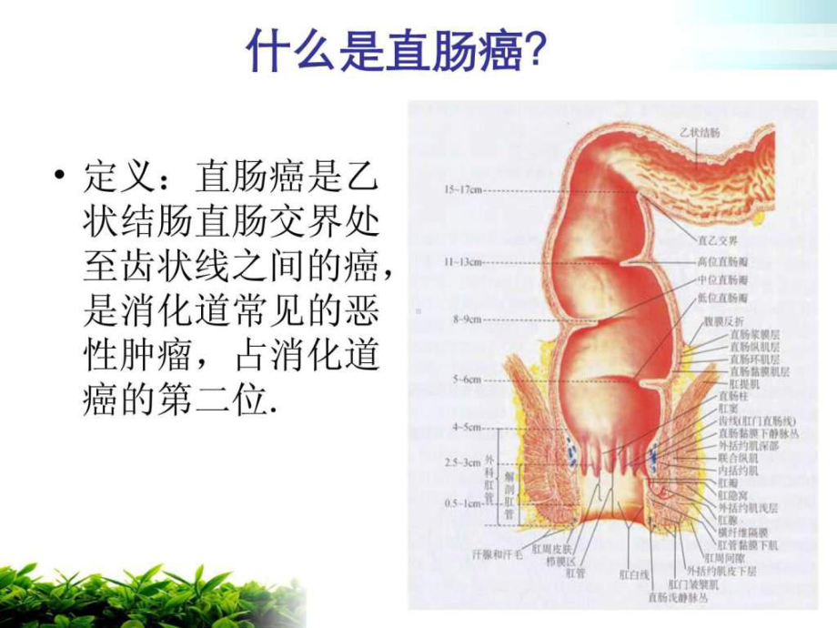 直肠癌-护理查房课件.ppt_第3页