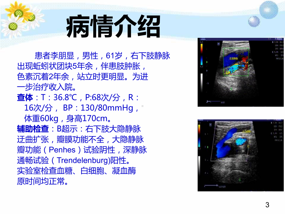 大隐静脉曲张护理案例介绍课件.pptx_第3页