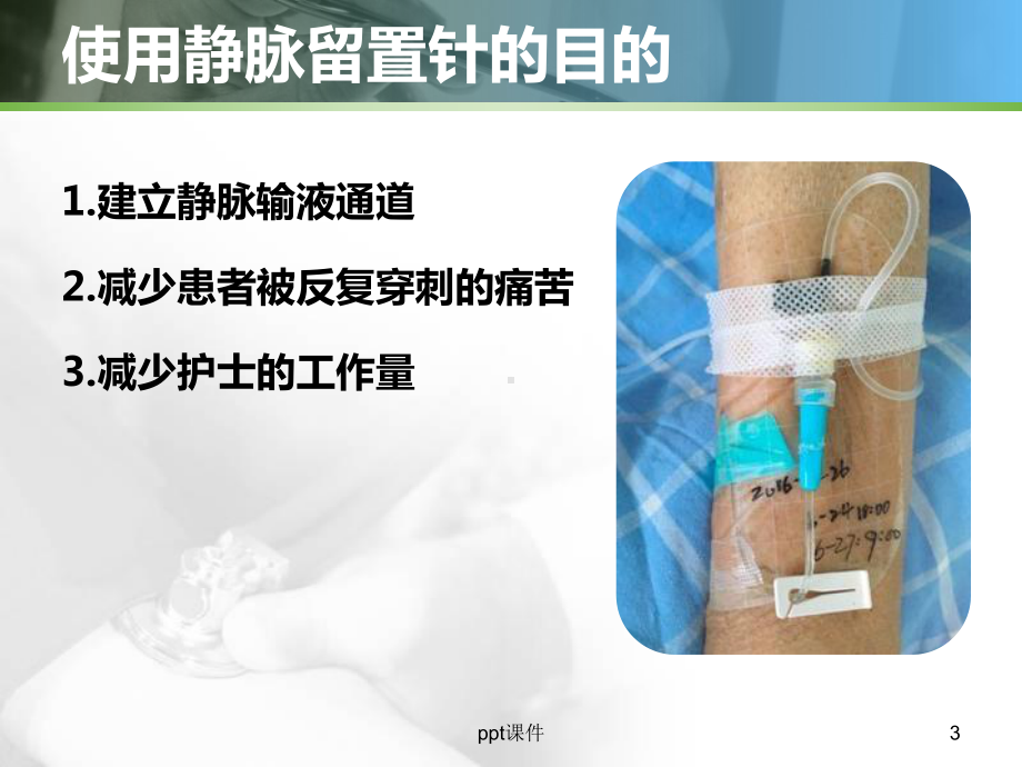 外周静脉留置针SOP流程课件.ppt_第3页