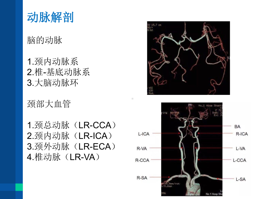 头颈联合CTA检查技术课件.pptx_第3页