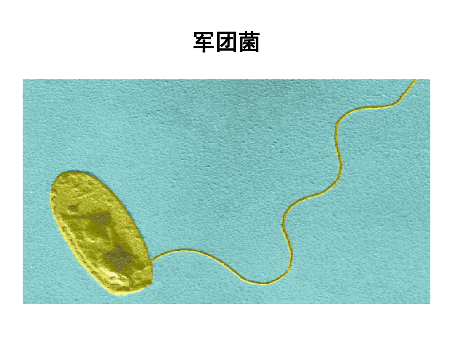 军团菌的分离培养与鉴定课件.ppt_第3页