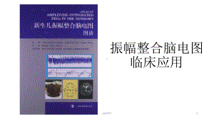 振幅整合脑电图课件.ppt