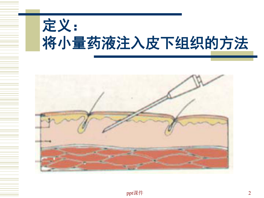 皮下注射技术操作流程课件.ppt_第2页