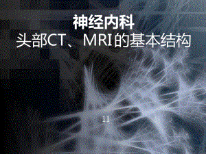 神经内科头部CTMRI的基本结构课件.ppt