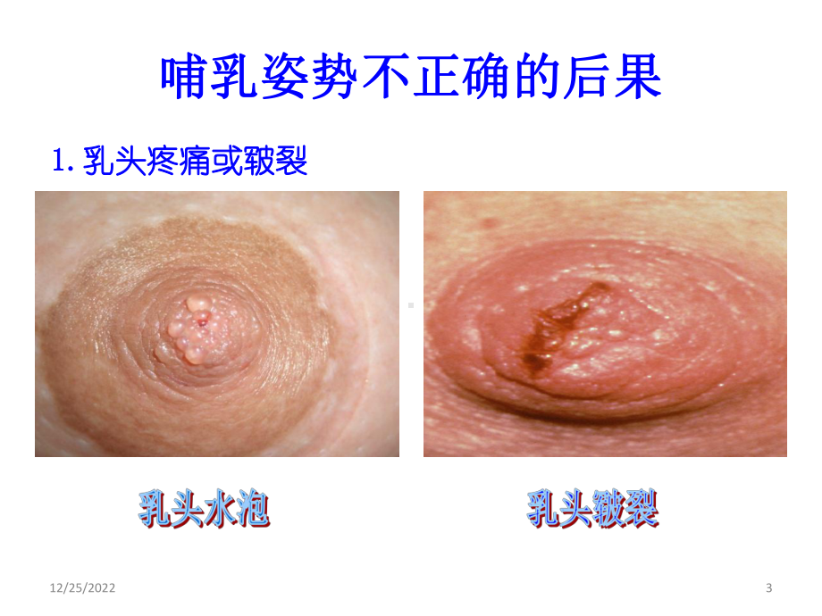 正确的哺乳姿势(课堂)课件.ppt_第3页