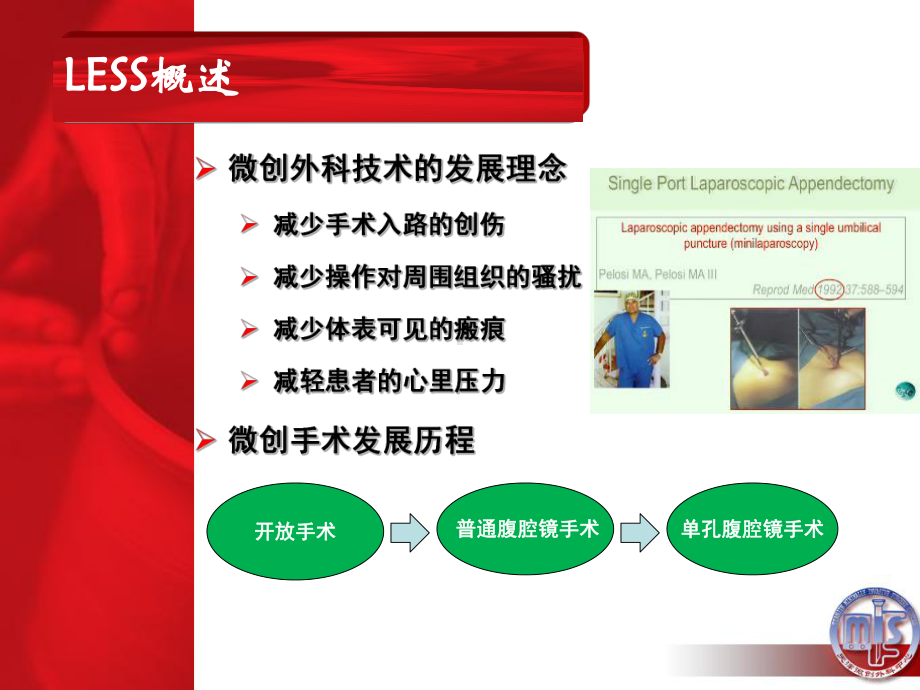 单孔腹腔镜2课件.ppt_第2页