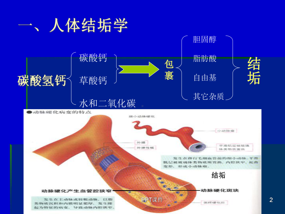 富氢水与疾病治疗课件.ppt_第2页