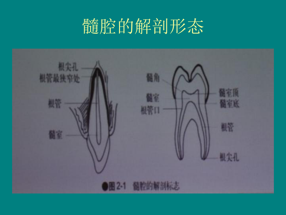 根管实战操作技巧课件.ppt_第3页