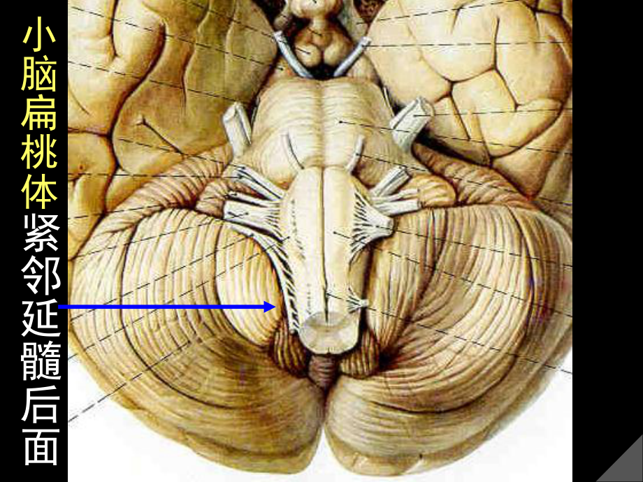 小脑分部课件.ppt_第2页