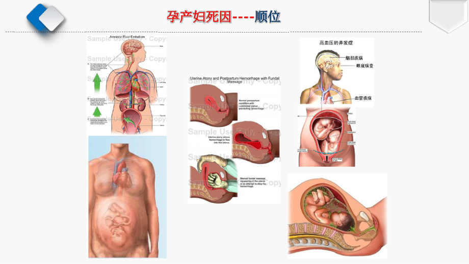 产后出血的诊疗策略课件.pptx_第3页