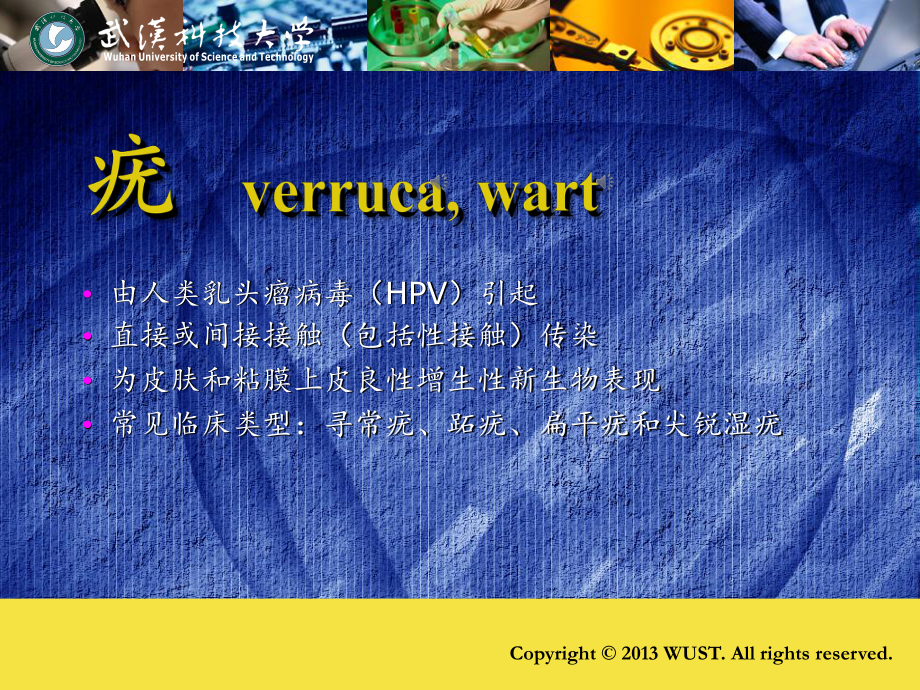 皮肤病学之-疣课件.ppt_第1页