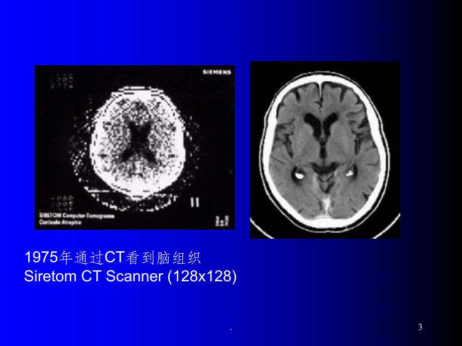 头颅CT精美完整课件.ppt_第3页