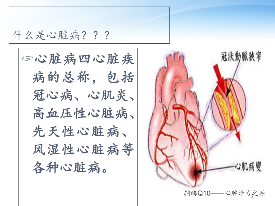 第一杀手—心脏病课件.ppt_第3页