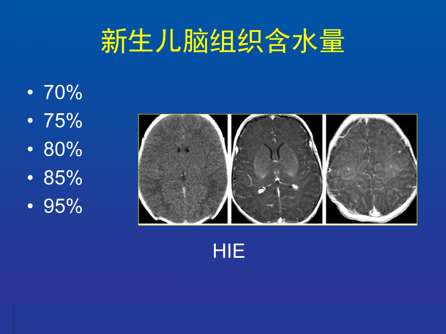 儿童神经系统影像诊断课件.ppt_第3页