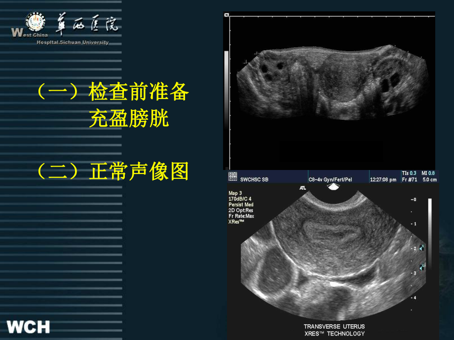 产前超声诊断妇产科及心脏超声2新课件.pptx_第3页